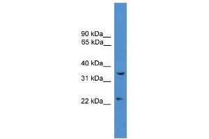 WB Suggested Anti-UCHL5 Antibody Titration: 0. (UCHL5 antibody  (Middle Region))