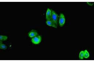 Immunofluorescent analysis of HepG2 cells using ABIN7143067 at dilution of 1:100 and Alexa Fluor 488-congugated AffiniPure Goat Anti-Rabbit IgG(H+L) (ACTL9 antibody  (AA 1-160))