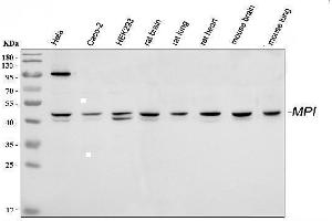 Western blot analysis of MPI using anti-MPI antibody (ABIN4886672). (MPI antibody  (AA 2-99))