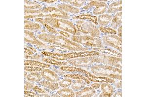 Immunohistochemistry of paraffin-embedded mouse kidney using [KO Validated] SIRT3 Rabbit mAb (ABIN7270324) at dilution of 1:100 (40x lens). (SIRT3 antibody)