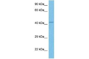 Host:  Rabbit  Target Name:  OTC  Sample Tissue:  Mouse Skeletal Muscle  Antibody Dilution:  1ug/ml (OTC antibody  (C-Term))