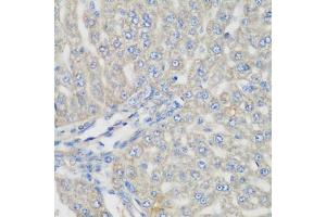 Immunohistochemistry of paraffin-embedded rat liver using METTL7A antibody (ABIN5974519) at dilution of 1/200 (40x lens). (METTL7A antibody)