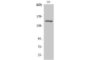 Western Blotting (WB) image for anti-Tyrosine Kinase 2 (TYK2) (Tyr260) antibody (ABIN3187388) (TYK2 antibody  (Tyr260))