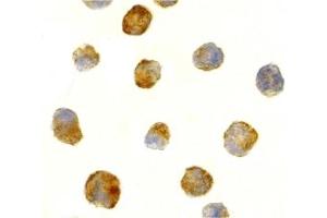 Immunohistochemistry (IHC) image for anti-ATR serine/threonine kinase (ATR) (C-Term) antibody (ABIN1030269) (ATR antibody  (C-Term))