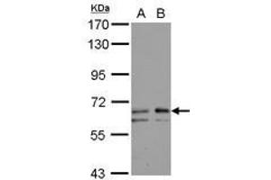 Image no. 2 for anti-UDP-N-Acetyl-alpha-D-Galactosamine:polypeptide N-Acetylgalactosaminyltransferase 2 (GalNAc-T2) (GALNT2) (AA 272-523) antibody (ABIN1498370) (GALNT2 antibody  (AA 272-523))