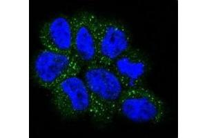 Confocal immunofluorescent analysis of NRAS antibody with NCI-H460 cells followed by Alexa Fluor 488-conjugated goat anti-rabbit lgG (green). (GTPase NRas antibody  (AA 72-101))