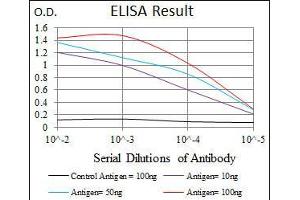 Black line: Control Antigen (100 ng), Purple line: Antigen(10 ng), Blue line: Antigen (50 ng), Red line: Antigen (100 ng), (LPA antibody  (AA 4330-4521))