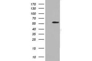 HEK293T cells were transfected with the pCMV6-ENTRY control (Left lane) or pCMV6-ENTRY DYNC1LI1 (Right lane) cDNA for 48 hrs and lysed. (DYNC1LI1 antibody)