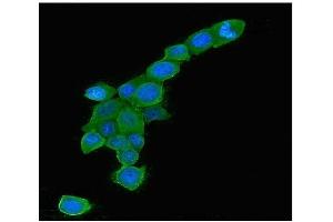 IF analysis of RAB5A using anti-RAB5A antibody (ABIN6719366). (RAB5 antibody  (C-Term))