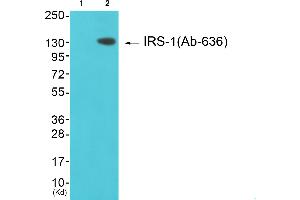 Immunohistochemical analysis of paraffin-embedded human brain, using IRS-1 (Ab-636/639) antibody. (IRS1 antibody  (Ser636, Ser639))