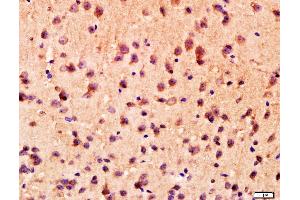 Mouse brain lysates probed with ANKK1 Polyclonal Antibody, unconjugated  at 1:400 overnight at 4°C followed by a conjugated secondary antibody for 20 minutes at 37°C. (ANKK1 antibody  (AA 101-200))