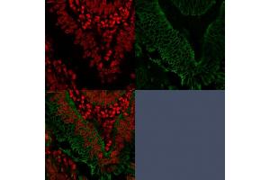 Immunofluorescence (IF) image for anti-Epithelial Cell Adhesion Molecule (EPCAM) (AA 77-202), (Extracellular Domain) antibody (ABIN6939977)