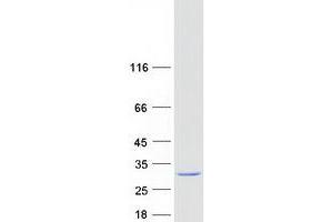 Validation with Western Blot (RAB6A Protein (Transcript Variant 2) (Myc-DYKDDDDK Tag))