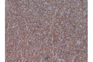 Detection of NPR3 in Rat Spinal cord Tissue using Polyclonal Antibody to Natriuretic Peptide Receptor 3 (NPR3) (NPR3 antibody  (AA 45-467))