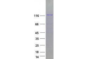 Validation with Western Blot (ZNF777 Protein (Myc-DYKDDDDK Tag))