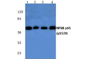 Western blot (WB) analysis of p-NFkB-p65 antibody at 1/500 diutionLane 1: MCF-7 whole cell lysate treated with UVLane 2: Raw264. (NF-kB p65 antibody  (pSer529))