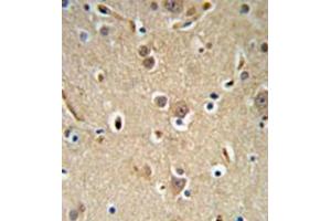 Immunohistochemistry analysis in formalin fixed and paraffin embedded brain tissue reacted with NEDD4 Antibody (C-term) followed which was peroxidase conjugated to the secondary antibody and followed by  DAB staining.