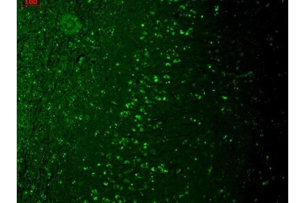 TRPM7 antibody  (AA 1817-1863)