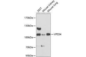 Western blot analysis of extracts of various cell lines, using VPS54 antibody (ABIN6133042, ABIN6150144, ABIN6150145 and ABIN6217132) at 1:3000 dilution. (VPS54 antibody  (AA 420-720))