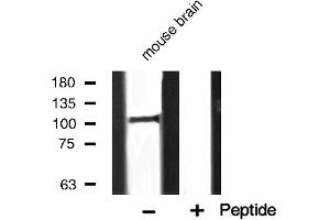 Western blot analysis of PERK expression in mouse brain (PERK antibody  (C-Term))