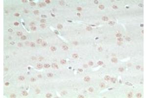 Image no. 2 for anti-rho GTPase Activating Protein 20 (ARHGAP20) (AA 570-620) antibody (ABIN207767)