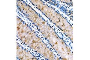 Immunohistochemistry of paraffin embedded human colon using FCGBP (ABIN7073926) at dilution of 1:800 (250x lens)