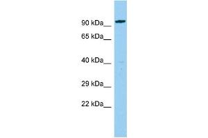 Host: Rabbit Target Name: CEP85L Sample Type: Fetal Liver lysates Antibody Dilution: 1. (C6orf204 antibody  (N-Term))