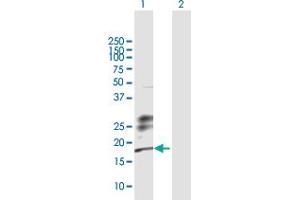 Western Blot analysis of KLRG1 expression in transfected 293T cell line by KLRG1 MaxPab polyclonal antibody. (KLRG1 antibody  (AA 1-189))