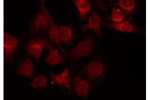 ABIN6272445 staining RAW264. (ZFP36L1 antibody  (Internal Region))