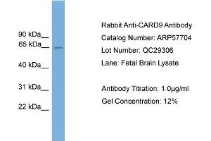 WB Suggested Anti-CARD9  Antibody Titration: 0. (CARD9 antibody  (Middle Region))