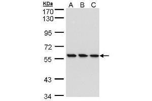 WB Image Sample (30 ug of whole cell lysate) A: HeLa B: Hep G2 , C: MOLT4 , 7. (RNGTT antibody)