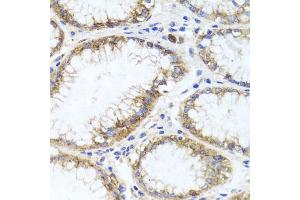 Immunohistochemistry of paraffin-embedded human stomach using GPM6A antibody (ABIN6134764, ABIN6141338, ABIN6141340 and ABIN6224880) at dilution of 1:100 (40x lens).