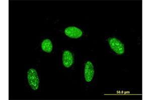 Immunofluorescence of monoclonal antibody to CDX1 on HeLa cell. (CDX1 antibody  (AA 126-215))