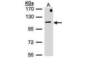 WB Image Sample(30 μg of whole cell lysate) A:MOLT4, 7.