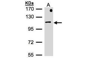 WB Image Sample(30 μg of whole cell lysate) A:MOLT4, 7. (AP2B1 antibody  (Internal Region))