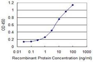 Detection limit for recombinant GST tagged PATZ1 is 0. (PATZ1 antibody  (AA 260-358))