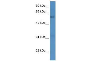 Western Blot showing FAM126A antibody used at a concentration of 1-2 ug/ml to detect its target protein. (FAM126A antibody  (C-Term))