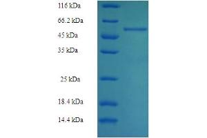 SDS-PAGE (SDS) image for Aldolase B, Fructose-Bisphosphate (ALDOB) (AA 2-364) protein (His-SUMO Tag) (ABIN4974993)
