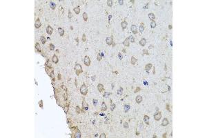 Immunohistochemistry of paraffin-embedded mouse brain using HBA2 antibody. (HBa2 antibody  (AA 1-142))
