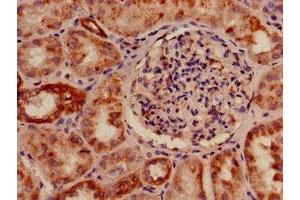 Immunohistochemistry of paraffin-embedded human kidney tissue using ABIN7142951 at dilution of 1:100 (SLC33A1 antibody  (AA 1-74))