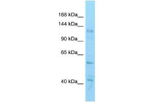 WB Suggested Anti-Hdac6 Antibody   Titration: 1. (HDAC6 antibody  (C-Term))