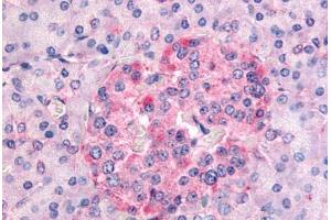 Immunohistochemistry (Paraffin-embedded Sections) (IHC (p)) image for anti-serum/glucocorticoid Regulated Kinase 1 (SGK1) (AA 419-431) antibody (ABIN214577)