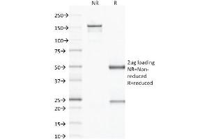 SDS-PAGE Analysis Purified CD79b Mouse Monoclonal Antibody (IGB/1843). (CD79b antibody  (AA 29-159))