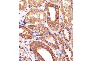 Paraformaldehyde-fixed, paraffin embedded human kidney tissue, Antigen retrieval by boiling in sodium citrate buffer (pH6. (ATG3 antibody)
