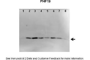 Lanes:   1. (PHF19 antibody  (C-Term))