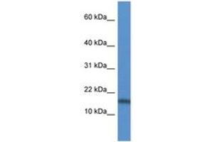 Image no. 1 for anti-Tumor Necrosis Factor (Ligand) Superfamily, Member 13 (TNFSF13) (AA 85-134) antibody (ABIN6747481)