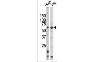 The anti-Phospho-Rad9- Pab (ABIN389633 and ABIN2839629) is used in Western blot to detect Phospho-Rad9- in HL60 (left) and Y79 (right) tissue lysates. (RAD9A antibody  (pSer328))
