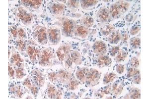 Detection of ST14 in Human Stomach Tissue using Monoclonal Antibody to Suppression Of Tumorigenicity 14 (ST14) (APLP2 antibody  (AA 607-852))