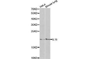 Western blot analysis of extracts of various cell lines, using IL18 antibody (ABIN1873197) at 1:1000 dilution. (IL-18 antibody)