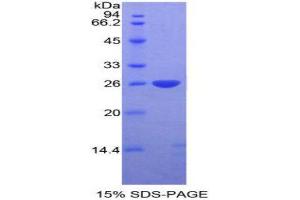 SDS-PAGE (SDS) image for DIX Domain Containing 1 (DIXDC1) (AA 513-711) protein (His tag) (ABIN2124655)
